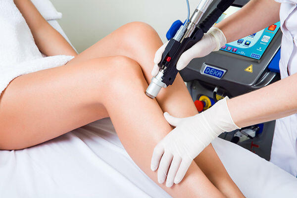 Hårbortagning i stockholm med alexandritlaser.